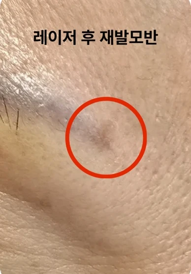 before_image