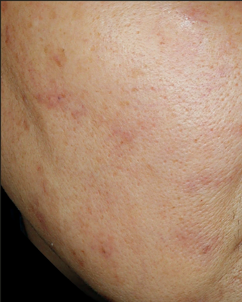 before_image