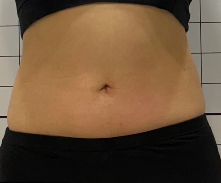before_image
