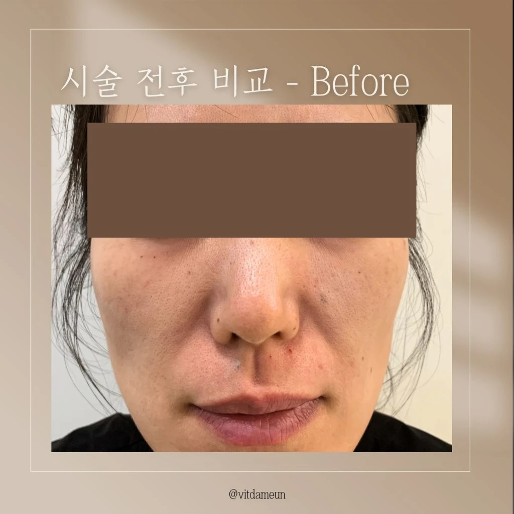 before_image