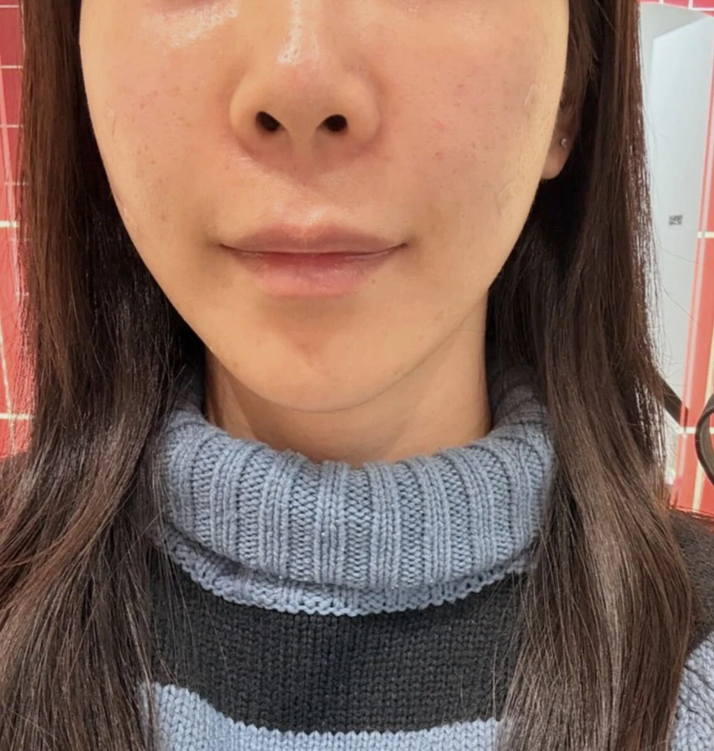 before_image