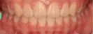before_image