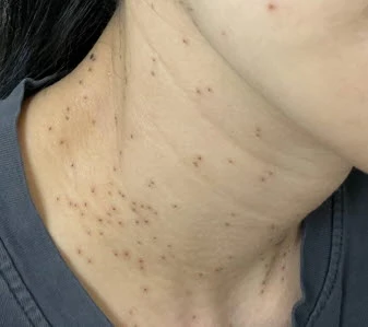 before_image