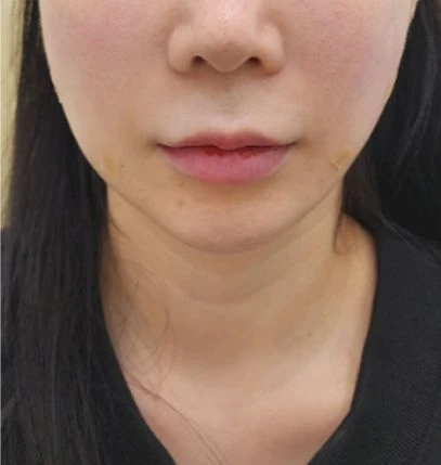 before_image