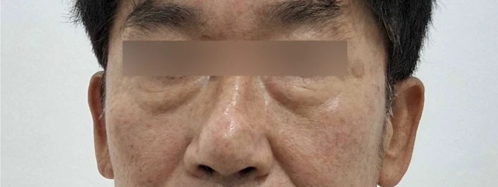 before_image