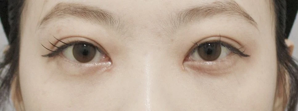 before_image