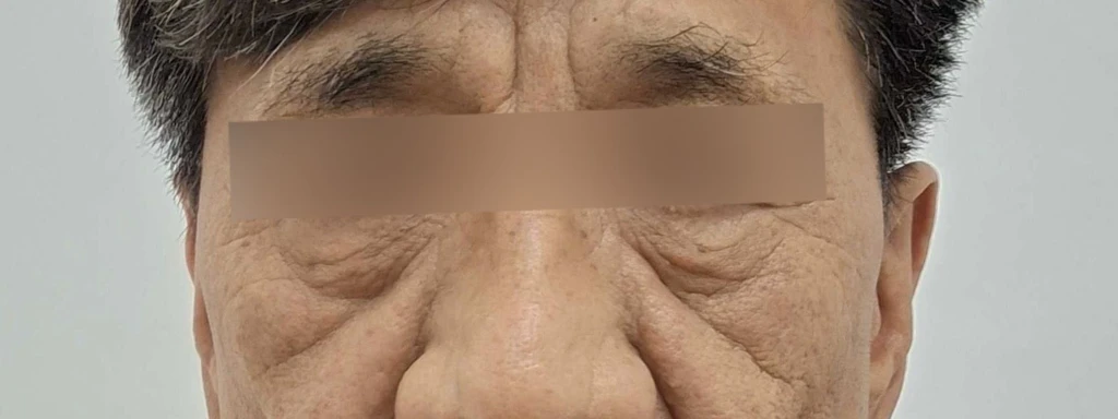 before_image