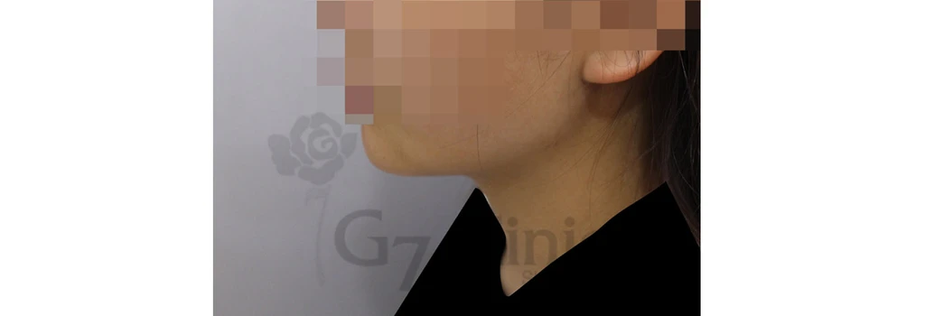 before_image