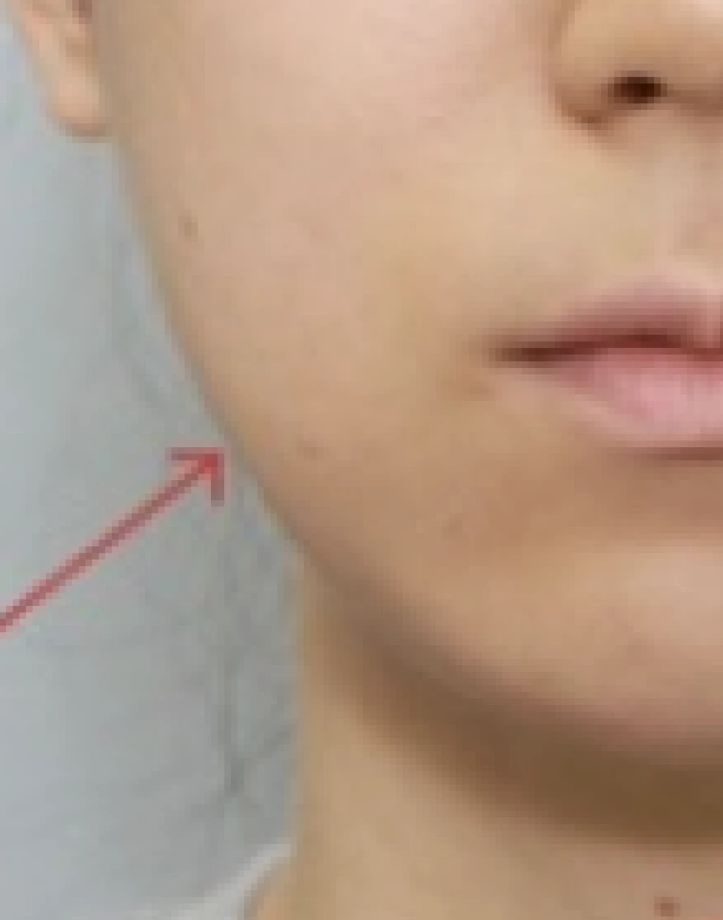 before_image
