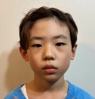 before_image