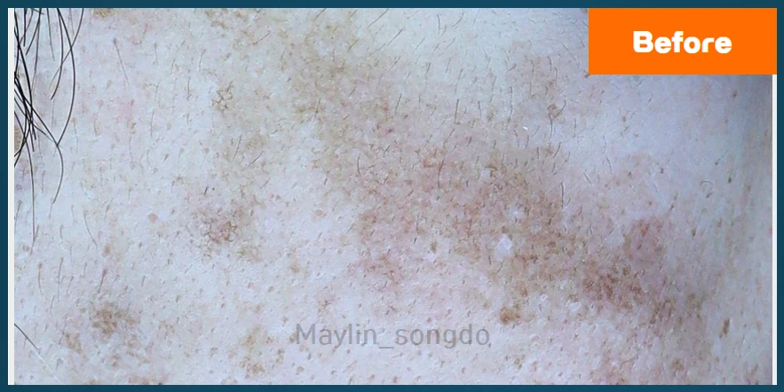 before_image