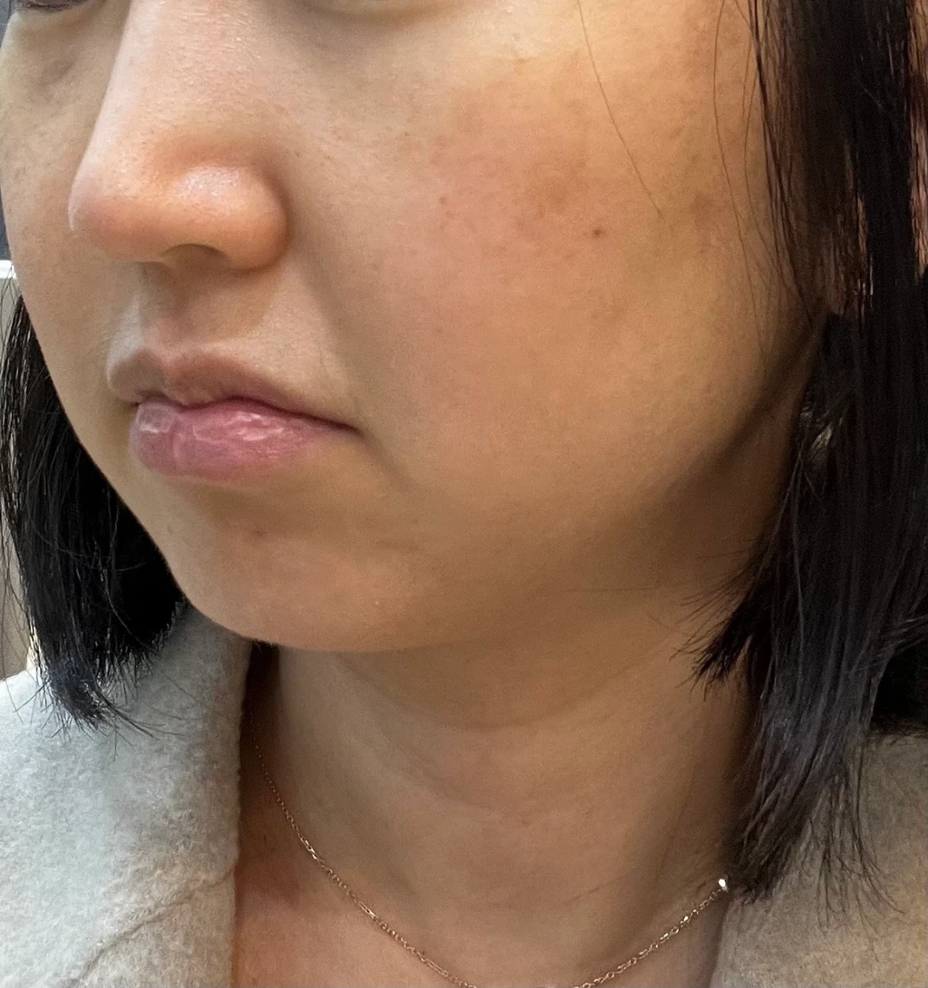 before_image