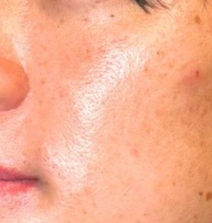 before_image
