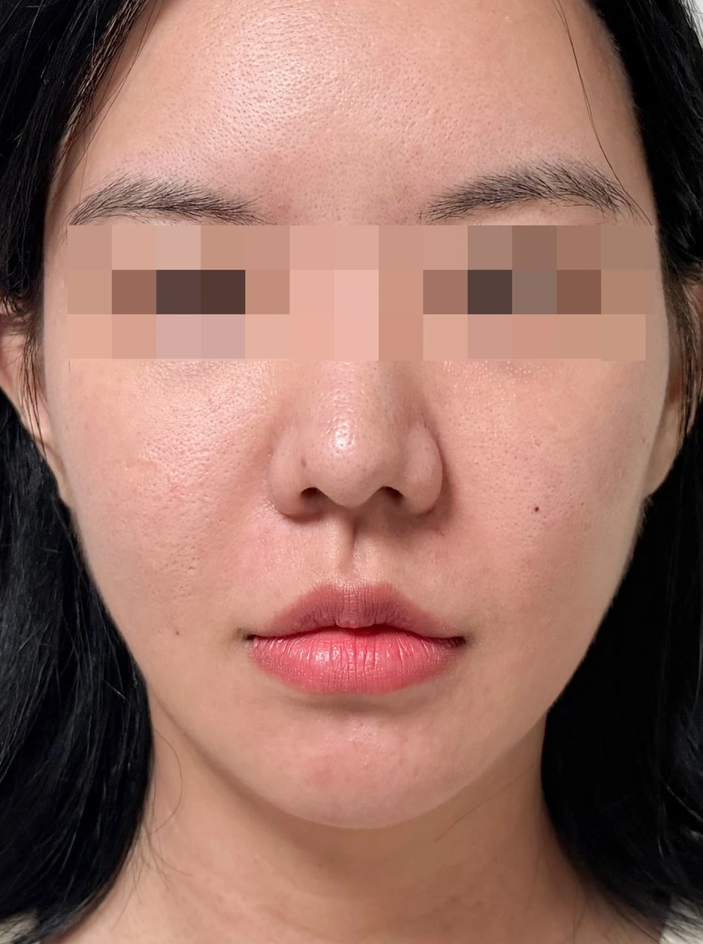 before_image