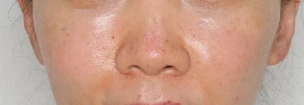 before_image