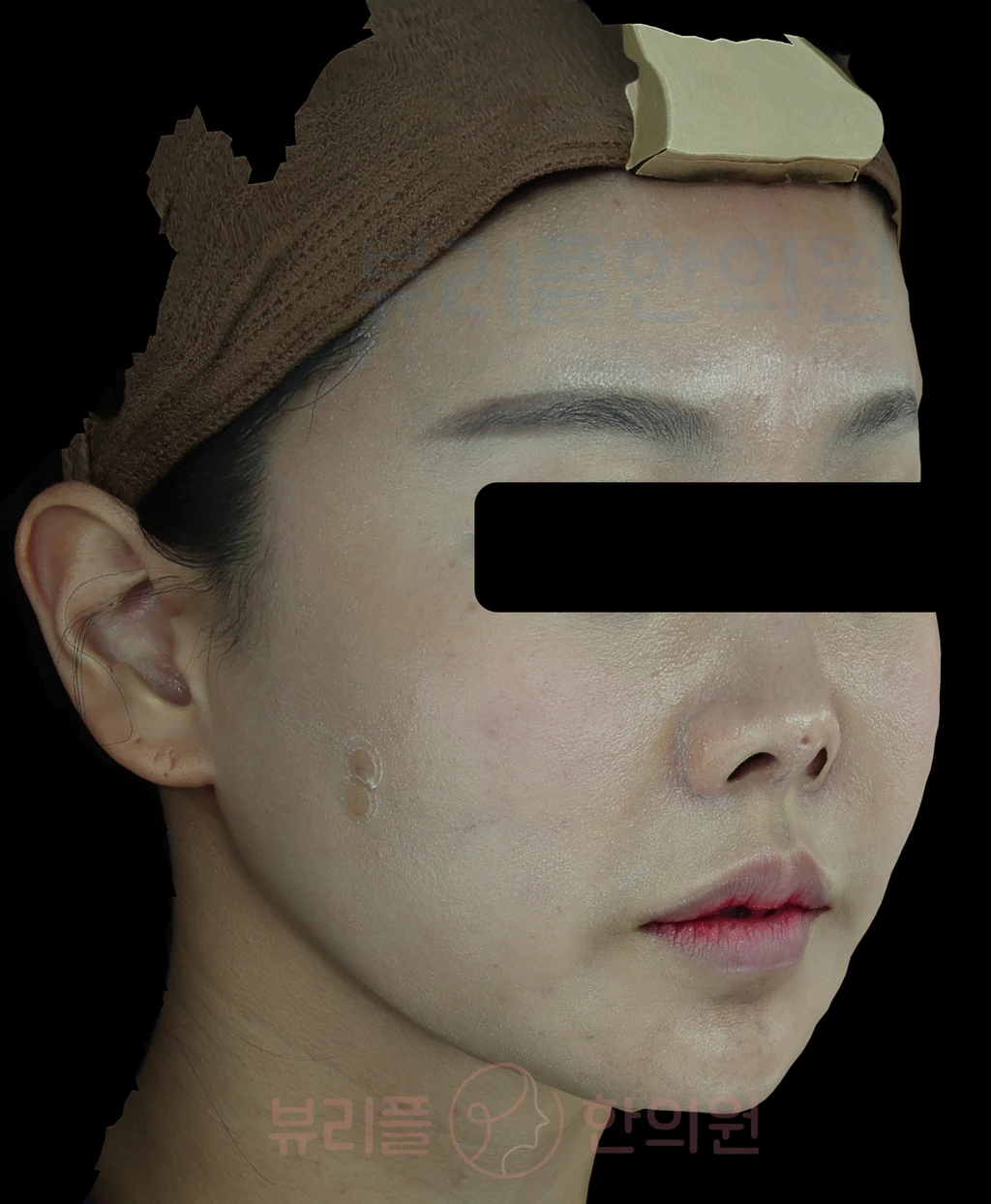 before_image
