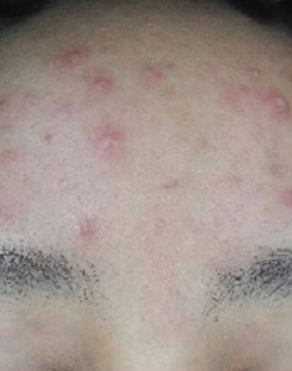 before_image