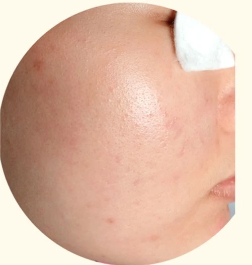 before_image