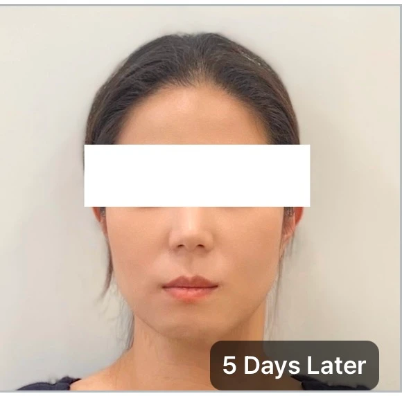 before_image