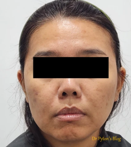 before_image
