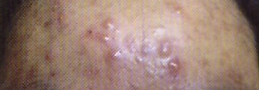 before_image