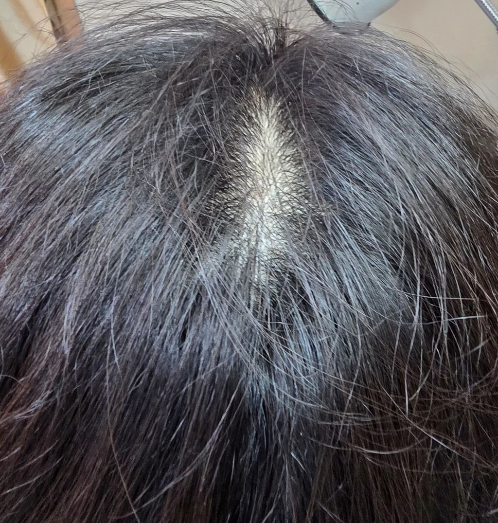 before_image