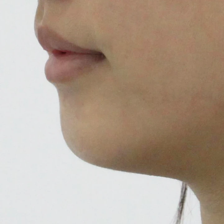 before_image