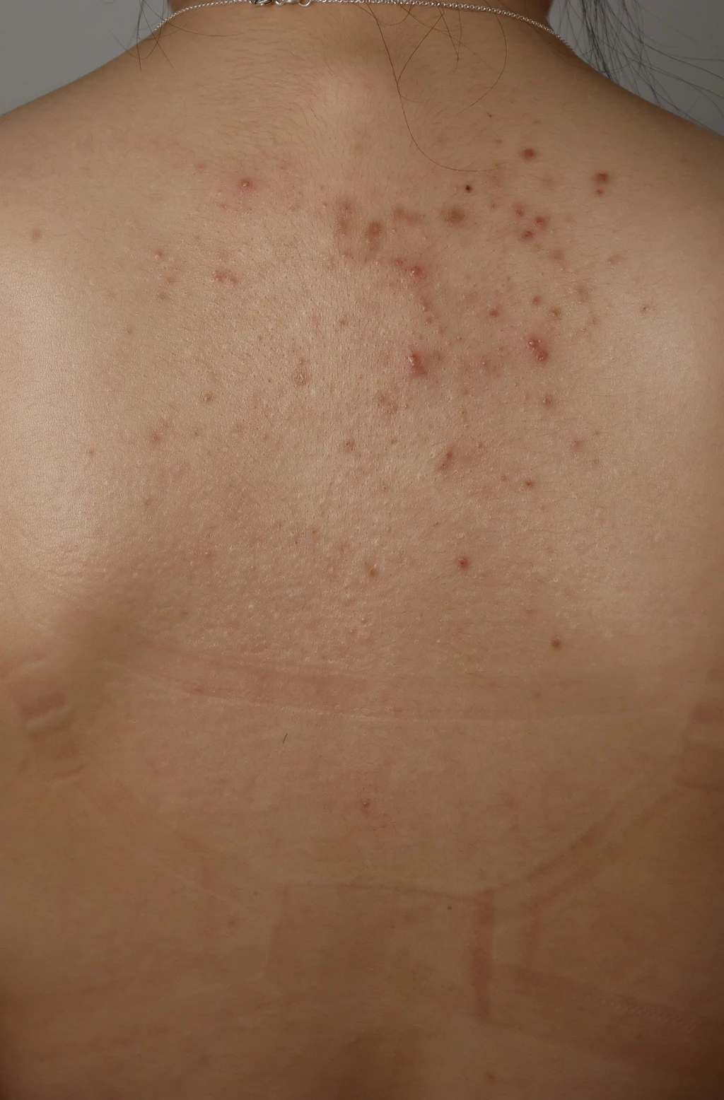 before_image
