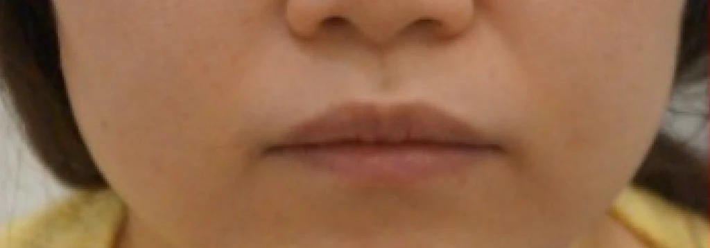 before_image