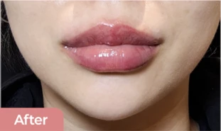before_image