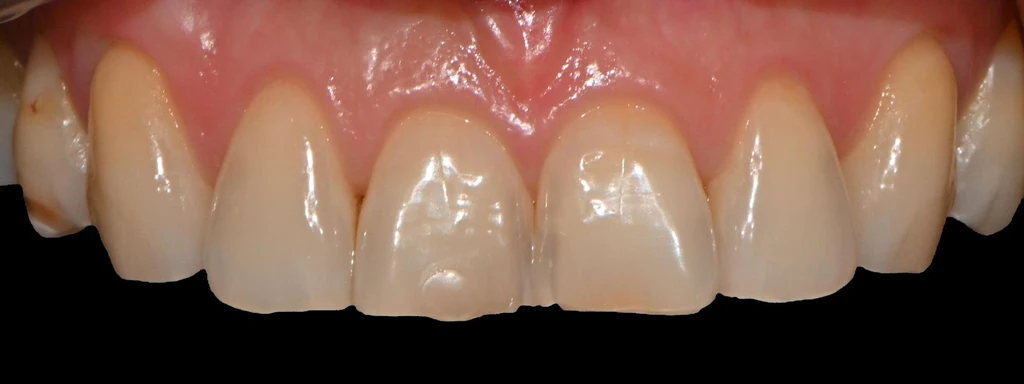 before_image