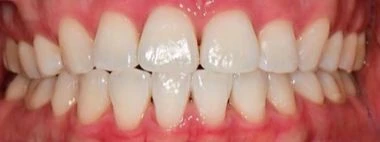 before_image