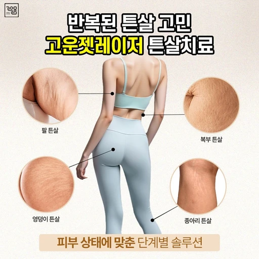 treatment-event-thumbnail