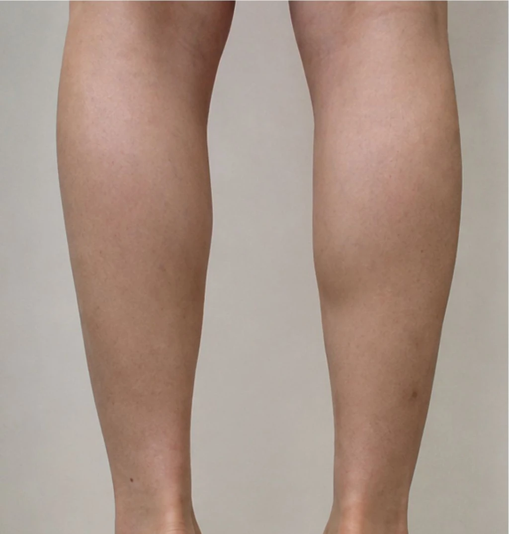 before_image