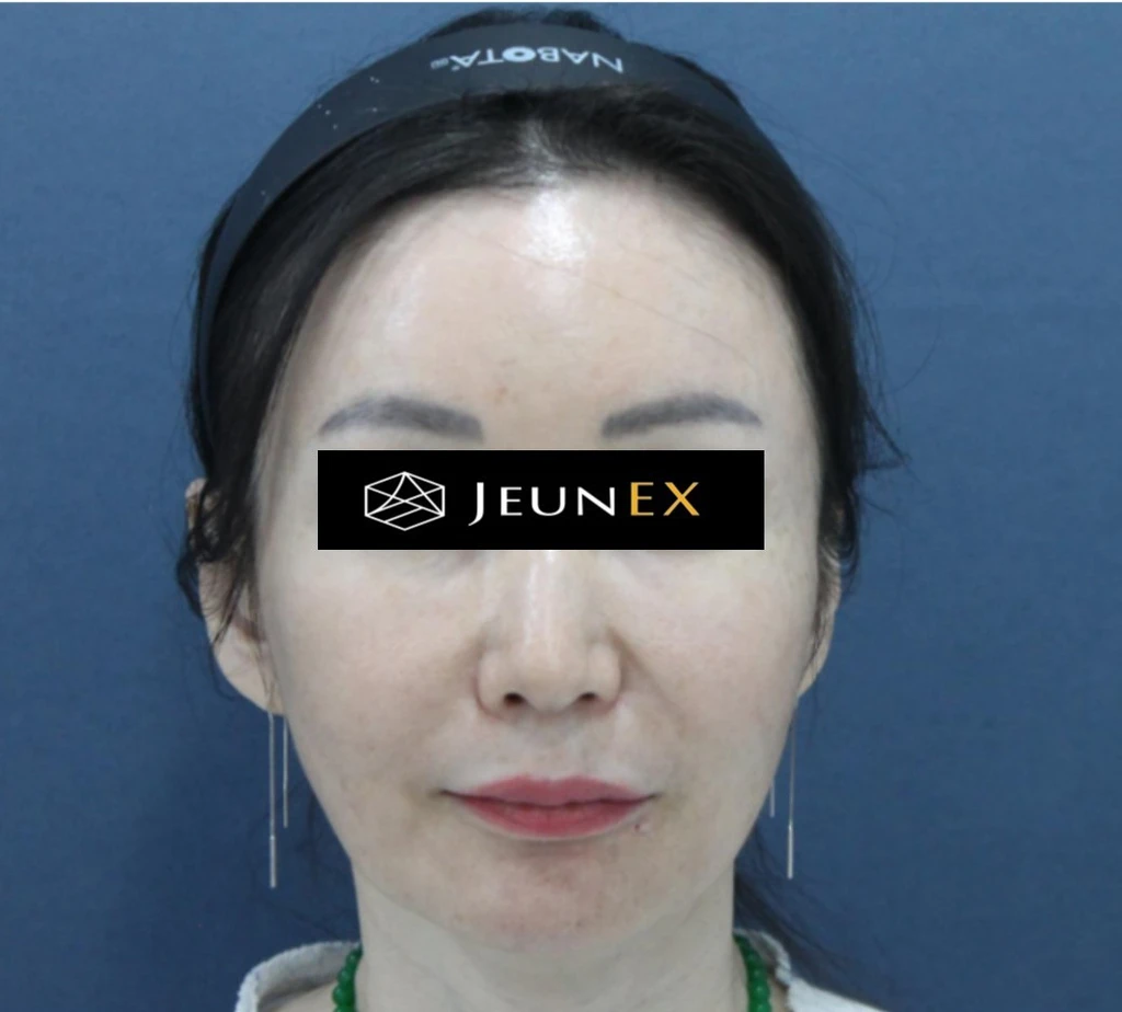 before_image