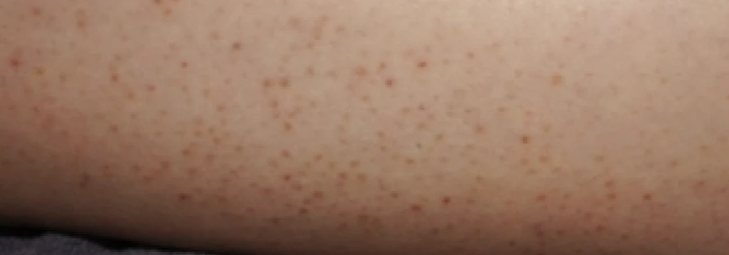 before_image