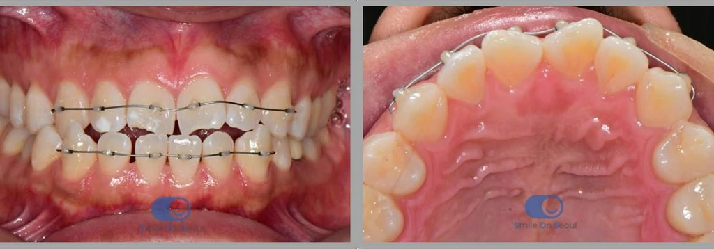 before_image