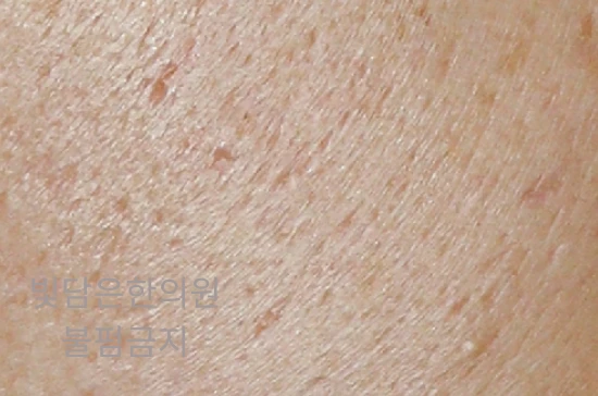 before_image