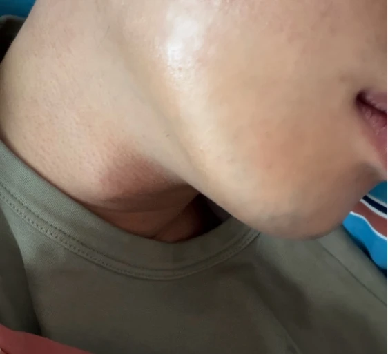 before_image