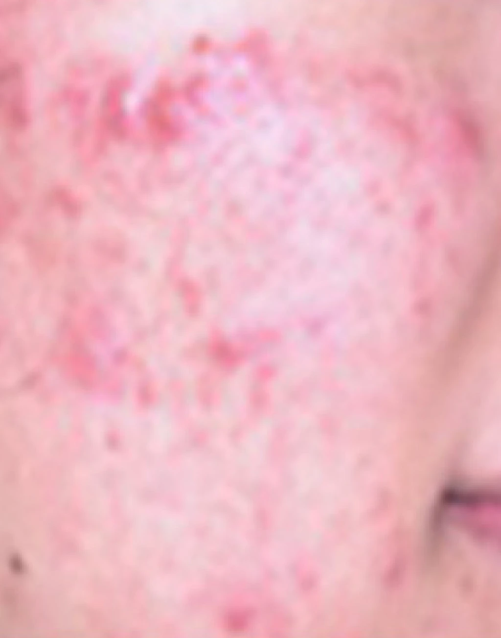 before_image