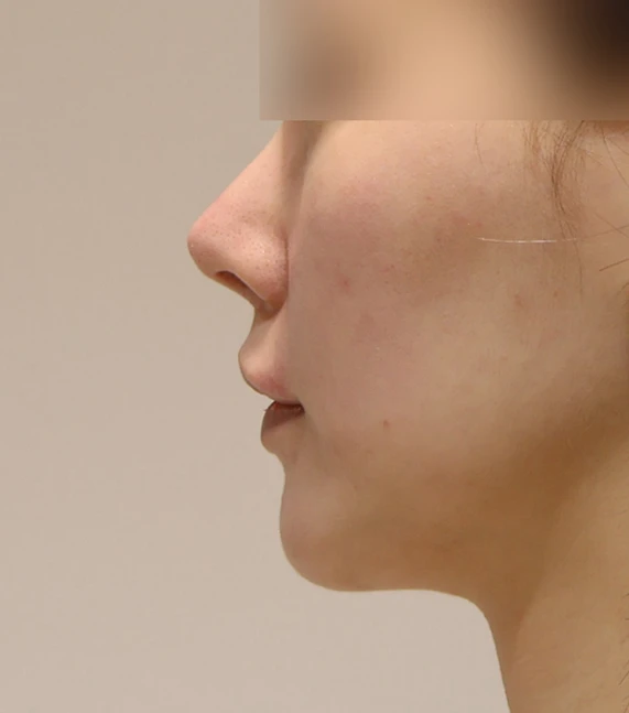 before_image