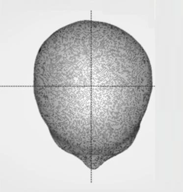 before_image