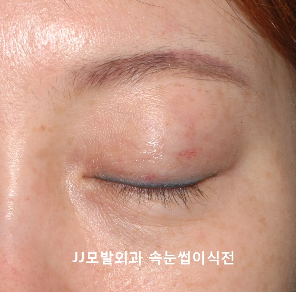 before_image
