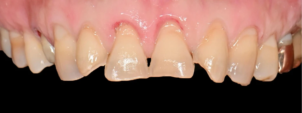 before_image