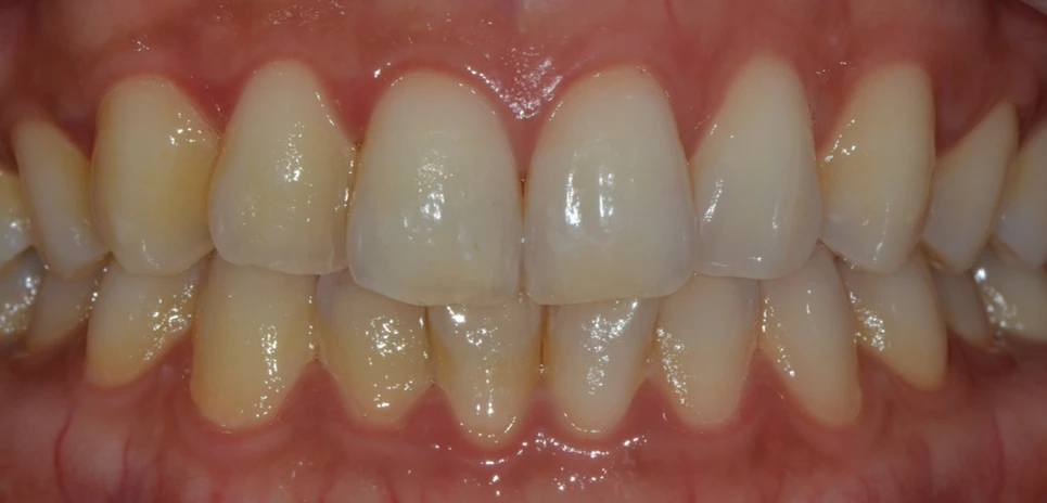 before_image