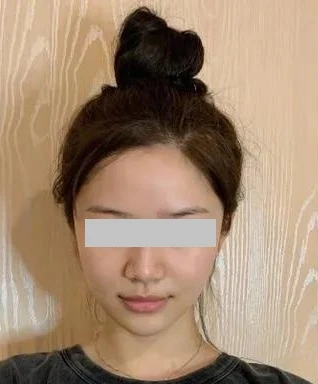 before_image