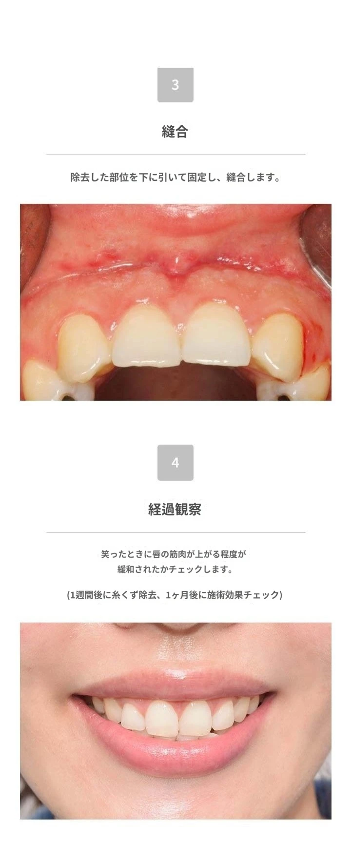 treatmentIntroduction