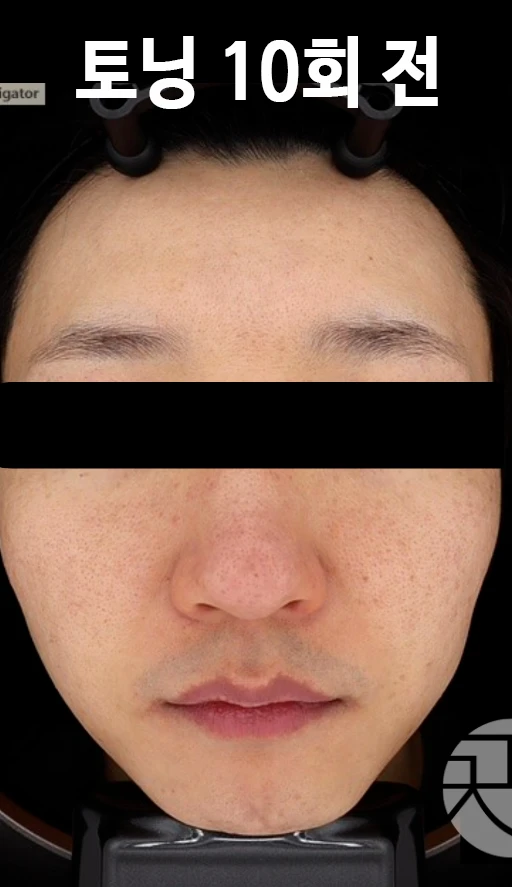 before_image
