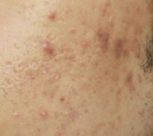 before_image