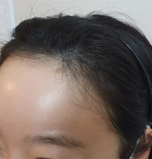 before_image